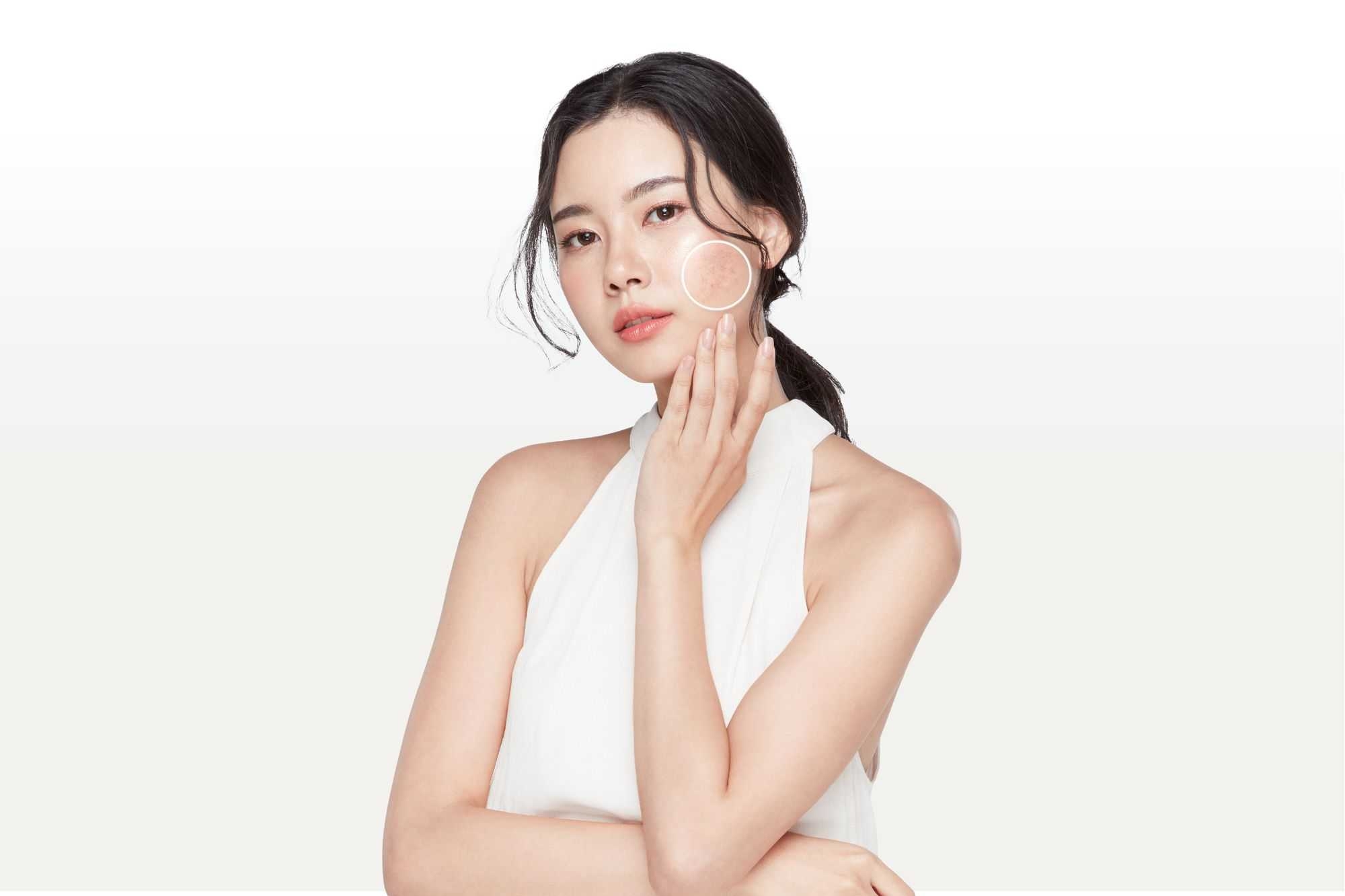 ปฎิวัติวงการฝ้า กระ ด้วยโปรแกรม “Code Of White” เผยผิวใหม่ พร้อมแล้วที่รมย์รวินท์ คลินิก
